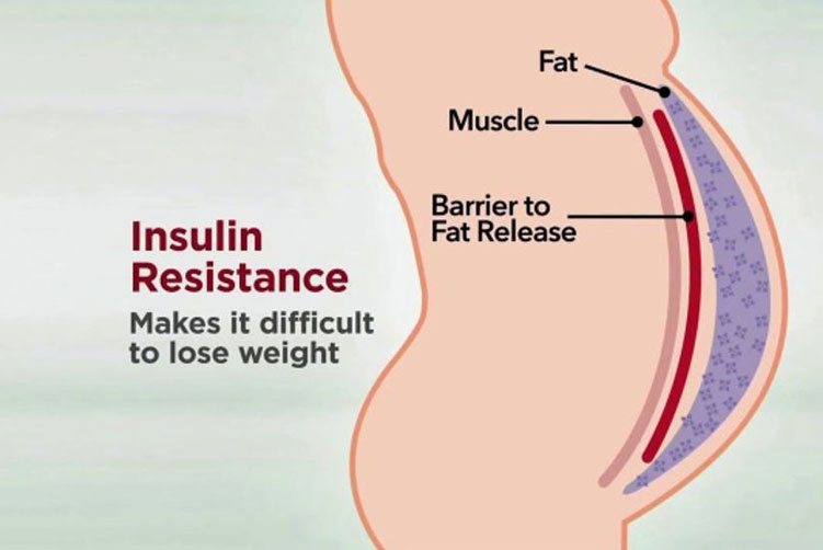 Reduced Insulin Resistance