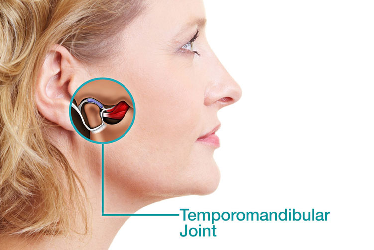 Temporomandibular Disorder